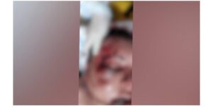 Briga generalizada termina com homem espancado e dois feridos a facadas em Santa Tereza do Oeste